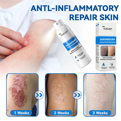 ⚕️ KUBOZN® Magnesium Herbal Psoriasis Spray ⚡3-MINUTE RELIEF