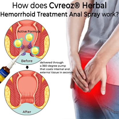 Cvreoz® Herbal Hemorrhoid Treatment Anal Spray Pro (Offer