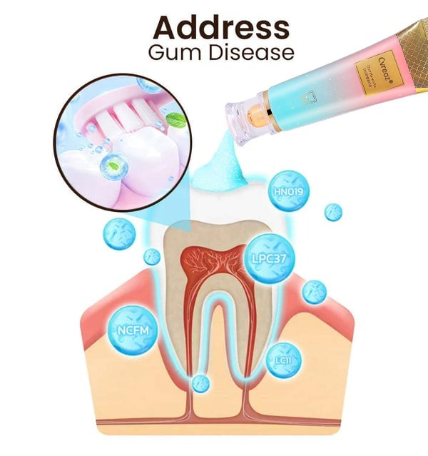 🔥Cvreoz® Niacinamide Intensive Whitening Toothpaste