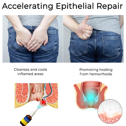 Cvreoz® Herbal Hemorrhoid Treatment Anal Spray Pro