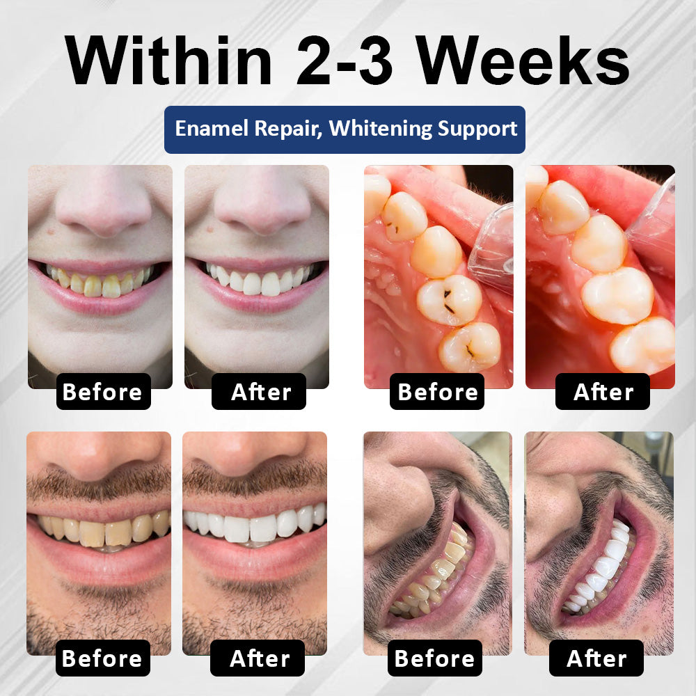 Healrize® BioEnamel Biomimetic Tooth Armor Drops