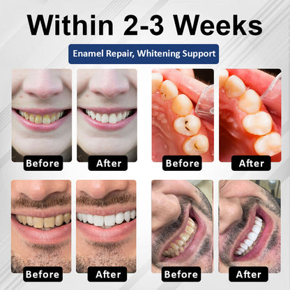 Healrize® BioEnamel Biomimetic Tooth Armor Drops