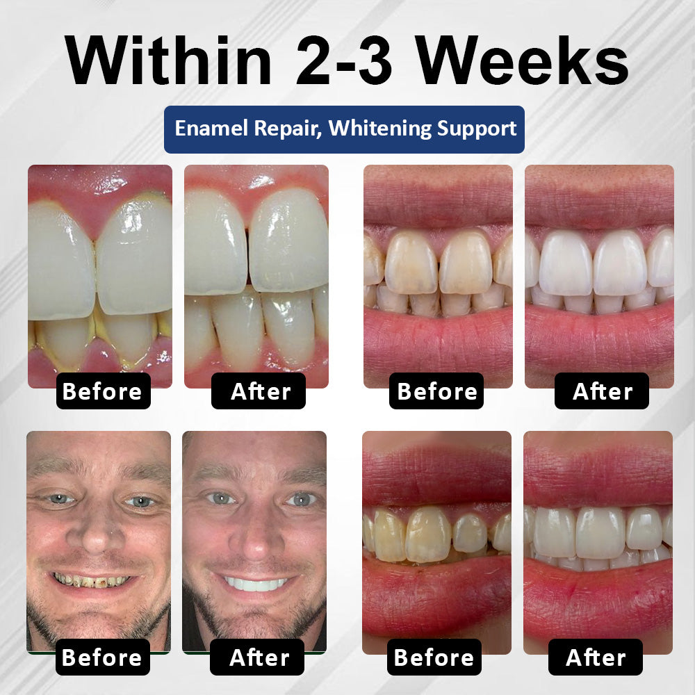 Healrize® BioEnamel Biomimetic Tooth Armor Drops