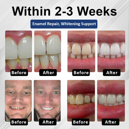 Healrize® BioEnamel Biomimetic Tooth Armor Drops