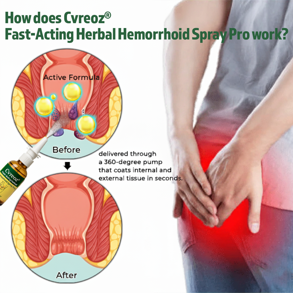 Cvreoz® Fast-Acting Herbal Hemorrhoid Spray Pro (offer)