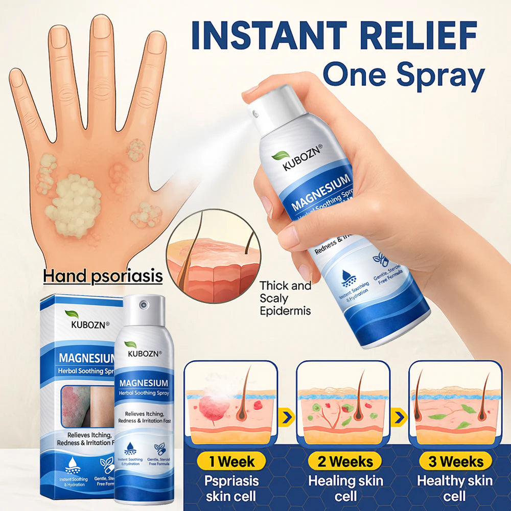 𝗢𝗳𝗳𝗶𝗰𝗶𝗮𝗹 𝗦𝘁𝗼𝗿𝗲 | KUBOZN® Magnesium Herbal Psoriasis Spray